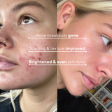 Pore Clarifying Brown Wash