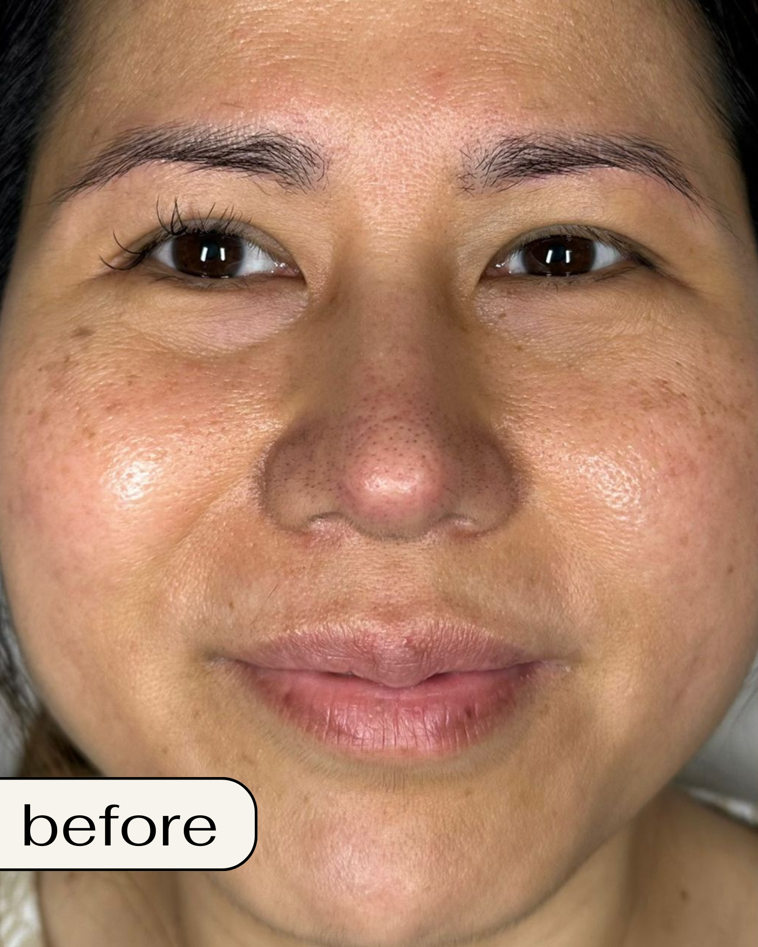 Chemical Peel in Orange County: Chemical peel Orange County, Best chemical peel OC, Chemical peel near me OC, Professional chemical peel Orange County, Gentle chemical peel OC, Affordable chemical peel Orange County, Best facial peel OC, Anti-aging chemical peel Orange County, Chemical peel for acne OC, Deep chemical peel Orange County, Chemical peel cost OC, Organic chemical peel Orange County, Sensitive skin chemical peel OC, Chemical peel for dark spots Orange County, Chemical peel for wrinkles OC, TCA peel Orange County, Orange County peel spa, Skin rejuvenation peel OC, Brightening chemical peel OC, Glow peel Orange County.  Best Spa in Orange County: Best spa in Orange County, Luxury spa Orange County, Relaxing spa OC, Spa day in Orange County, Full-service spa OC, Facial spa Orange County, Organic spa Orange County, Award-winning spa OC, Top rated spa Orange County, Affordable spa OC, Day spa Orange County, Wellness spa OC, Rejuvenating spa OC, Anti-aging spa Orange County, Spa for acne treatment OC, Natural skincare spa Orange County, Couples spa Orange County, Med spa Orange County, Skincare spa OC, Personalized spa treatments OC.  BioRePeel in Orange County: BioRePeel Orange County, BioRePeel treatment OC, BioRePeel facial Orange County, BioRePeel peel OC, Where to get BioRePeel OC, BioRePeel specialist Orange County, Best BioRePeel treatment OC, BioRePeel for sensitive skin Orange County, Anti-aging BioRePeel OC, BioRePeel for acne Orange County.