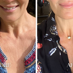 neck firming cream, best neck cream for sagging skin, neck lift cream, jawline firming cream, anti-aging cream for neck and chest, cream for neck lines, neck wrinkle cream, best cream for turkey neck, firming neck and décolleté cream, lifting cream for jawline, best cream for double chin, tighten neck skin naturally, collagen boosting neck cream, anti-aging décolletage cream, sagging skin neck cream, neck firming moisturizer, firming cream for mature skin, rejuvenating neck cream, advanced neck repair cream